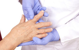 4 best remedies for rheumatoid arthritis 