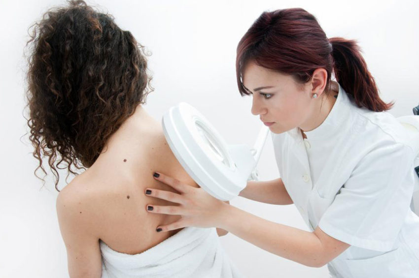 5 ways to reduce the risk of melanoma
