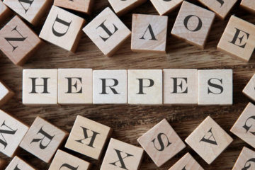 An overview of herpes