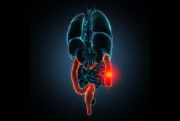 Popular treatments for irritable bowel syndrome