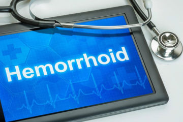What are the causal factors of hemorrhoids?