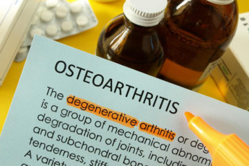 What are the treatment options for managing osteoarthritis