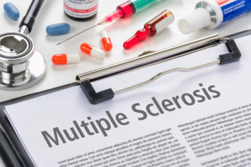 An overview of multiple sclerosis